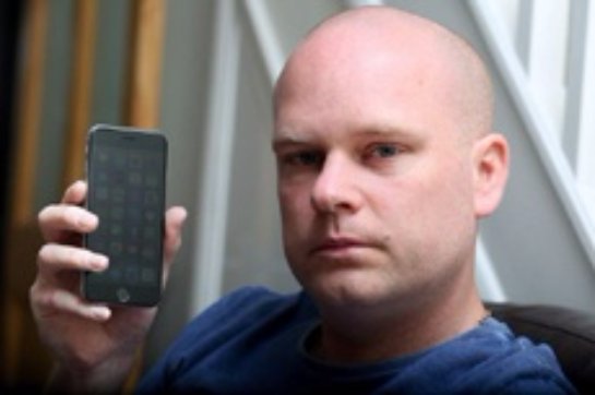 У 37-летнего британца началась аллергия  на iPhone 6